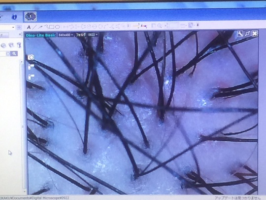 �`�f�`�X�L���N���j�b�N