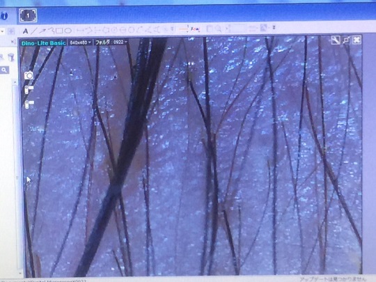 �`�f�`�X�L���N���j�b�N